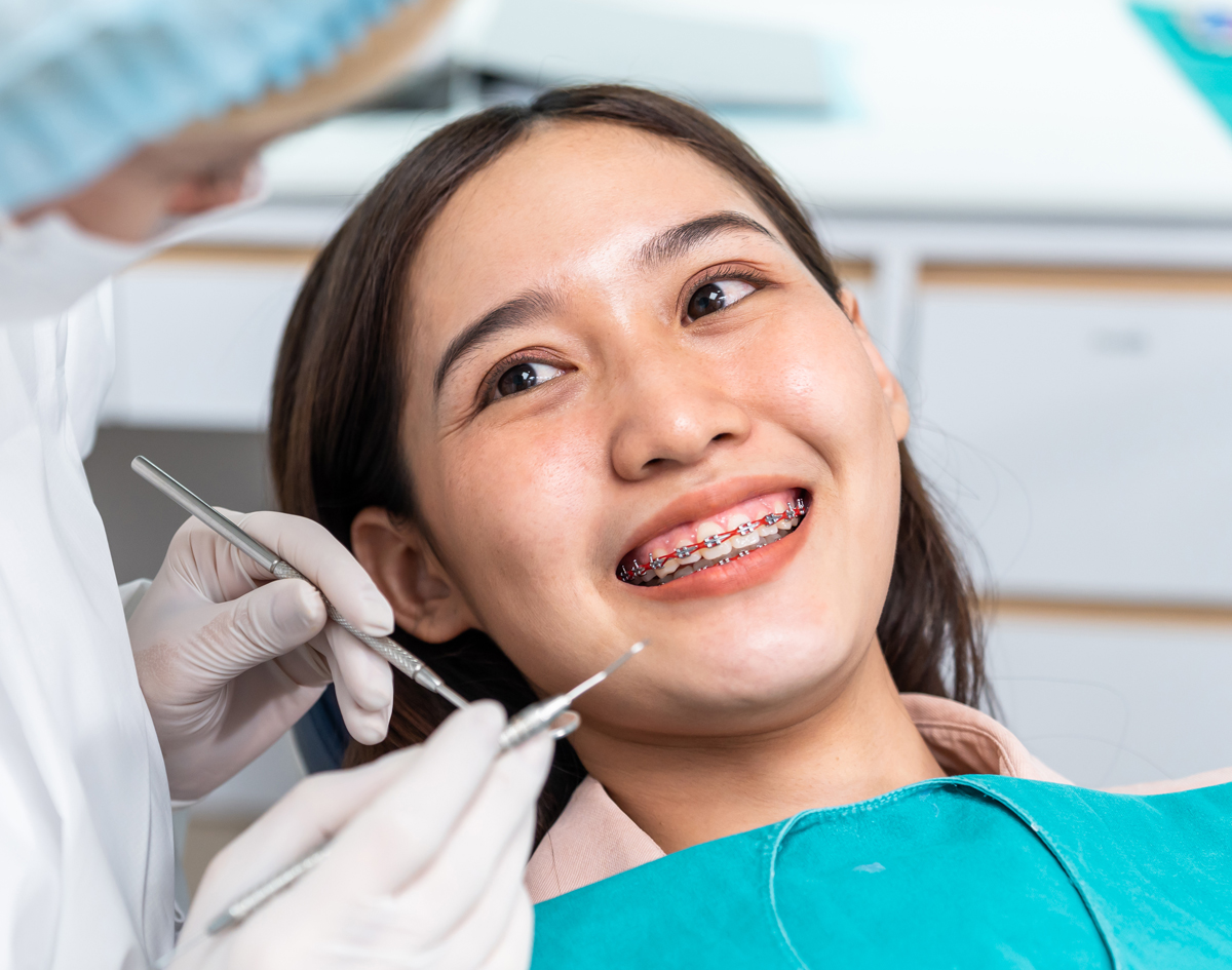 Smiling With Braces